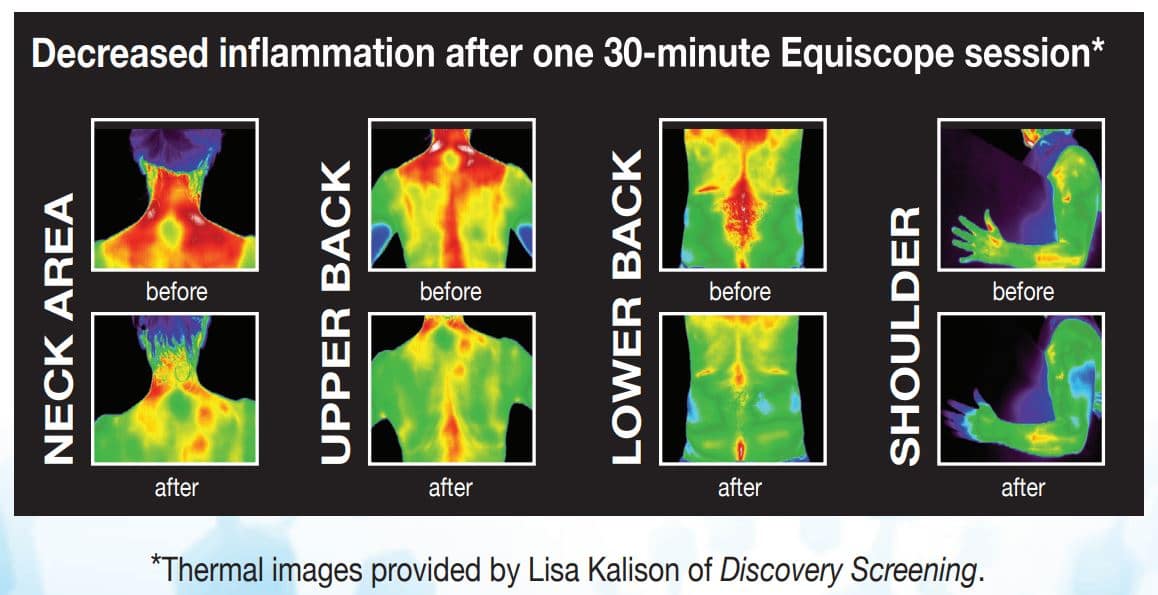 Equiscope Therapy | Nava Health & Vitality Center