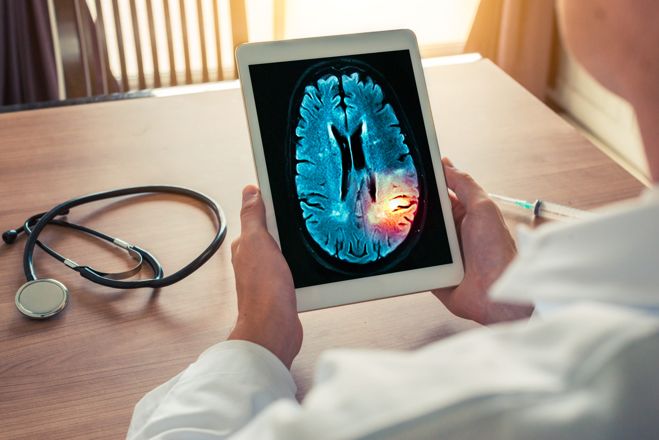 Doctor reviewing brain scan image