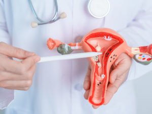 Doctor holding model of reproductive organs to illustrate hormone therapy after hysterectomy